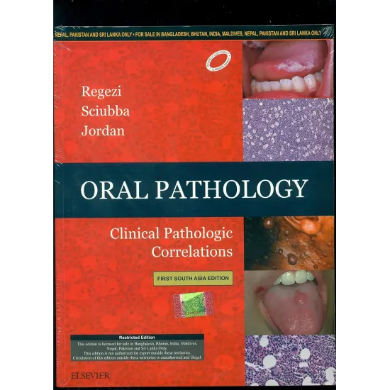 Oral Pathology - 1E