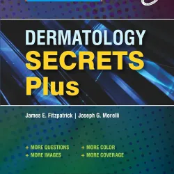 Dermatology Secrets Plus, 1st SAE