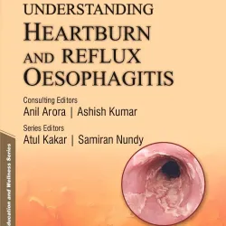 Understanding Heartburn & Reflux Oesophagitis - 1E