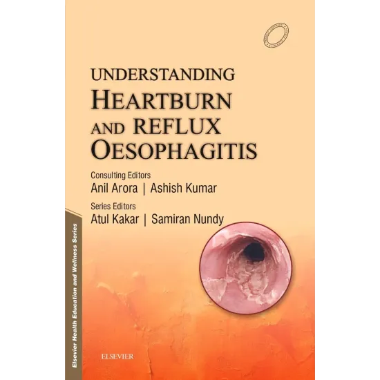 Understanding Heartburn & Reflux Oesophagitis - 1E