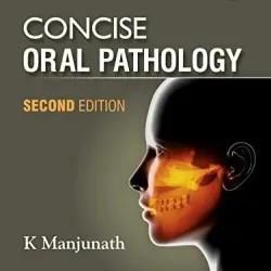 Concise Oral Pathology - 2E