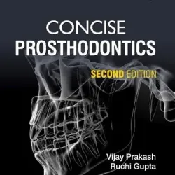 Concise Prosthodontics - 2E