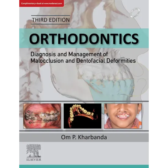 Orthodontics: Diagnosis and Mgmt. of Malocclusion & Dentofacial Deformities - 3E