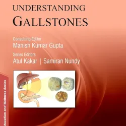 Understanding Gallistones - 1E