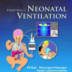 Essentials of Neonatal Ventilation -1E