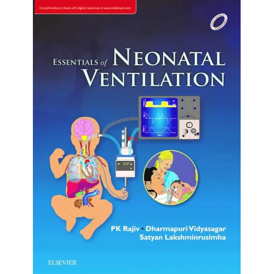 Essentials of Neonatal Ventilation -1E