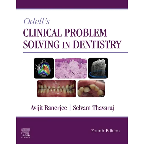 Odell's Clinical Problem Solving in Dentistry - 4E