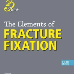 The Elements of Fracture Fixation - 5E