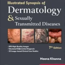 Illustrated Synopsis of Dermatology and Sexually Transmitted Diseases -7E