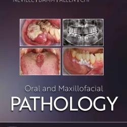 Oral and Maxillofacial Pathology (SAE) -5E