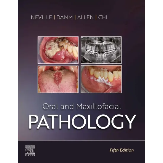 Oral and Maxillofacial Pathology (SAE) -5E