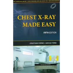 Chest X-Ray Made Easy (SAE) -5E