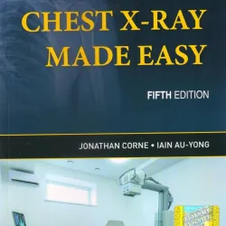 Chest X-Ray Made Easy (SAE) -5E