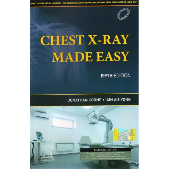 Chest X-Ray Made Easy (SAE) -5E