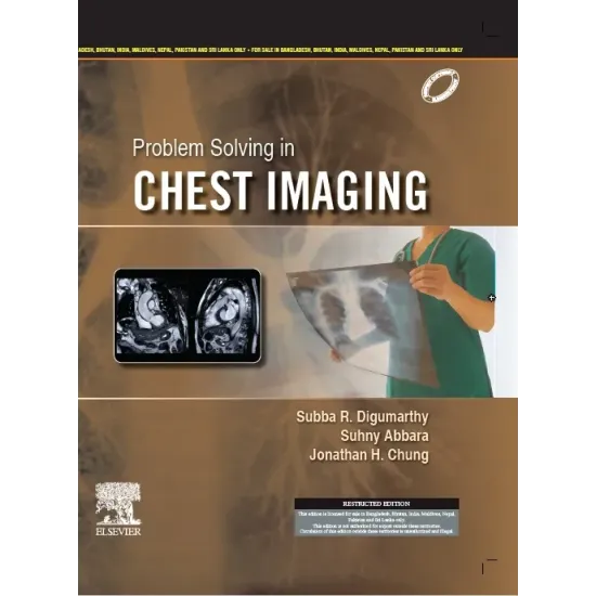 Problem Solving in Chest Imaging (SAE) -1E