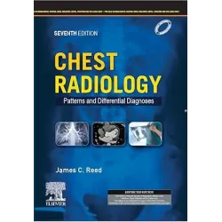 Chest Radiology: Patterns and Differential Diagnoses (SAE) -7E