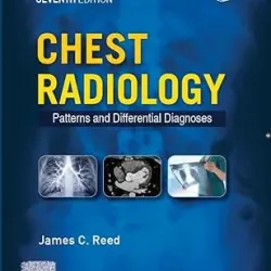 Chest Radiology: Patterns and Differential Diagnoses (SAE) -7E