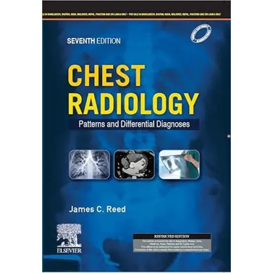 Chest Radiology: Patterns and Differential Diagnoses (SAE) -7E