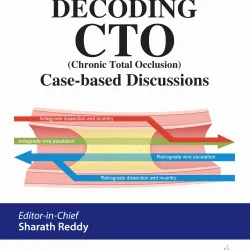 Decoding Cto (Chronic Total Occlusion) Case-Based Discussions