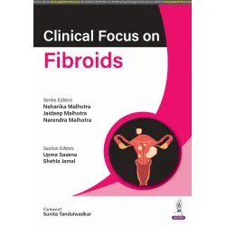 Clinical Focus On Fibroids