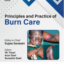 Principles And Practice Of Burn Care