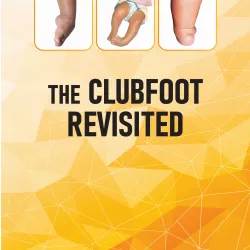 The Clubfoot Revisited