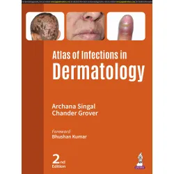 Atlas Of Infections In Dermatology