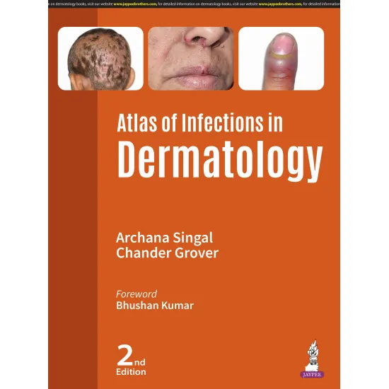 Atlas Of Infections In Dermatology