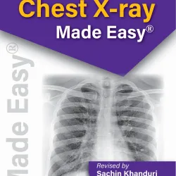 Karthikeyan'S Chest X-Ray Made Easy