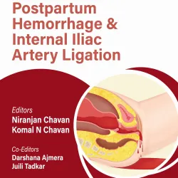 Obs And Gynae Pg Focus Series Postpartum Hemorrhage & Internal Iliac Artery Ligation