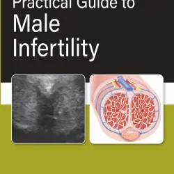 Practical Guide To Male Infertility