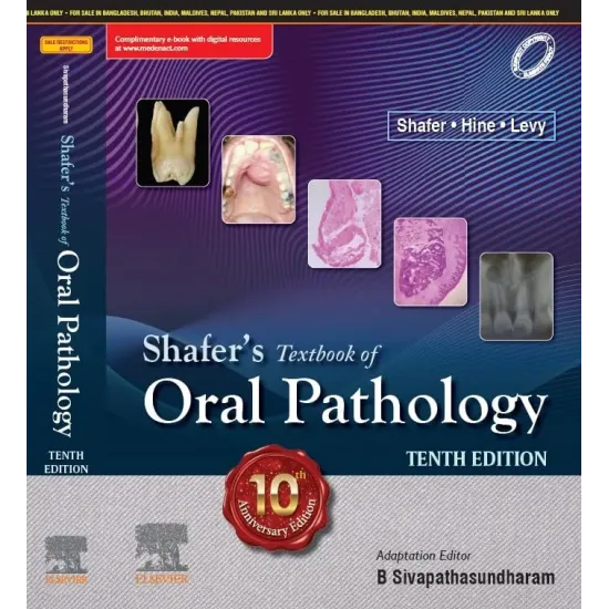 Shafer's Textbook of Oral Pathology - 10E